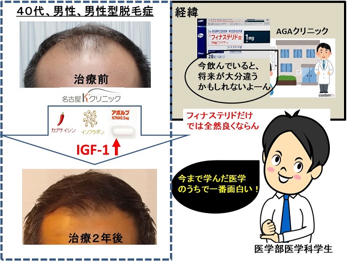 円形脱毛症　病院